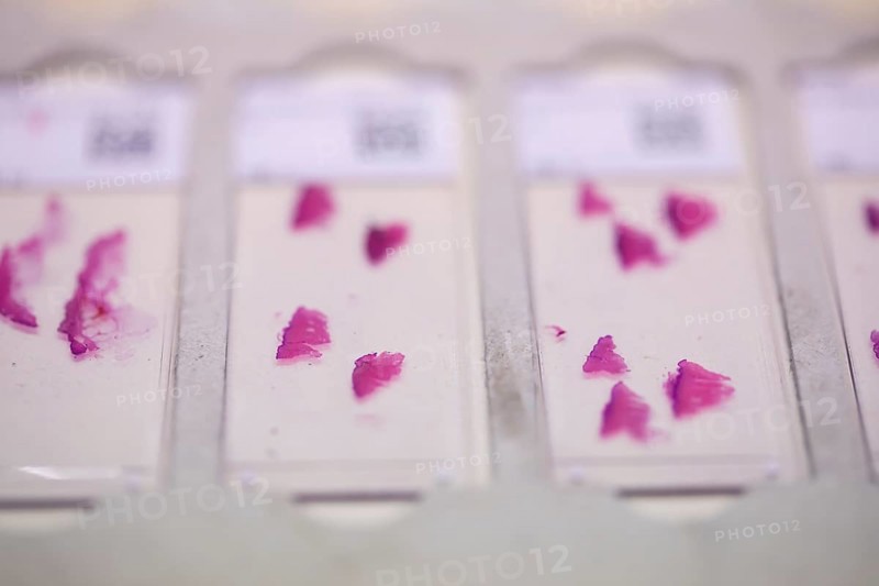 Embedded samples in a histology laboratory