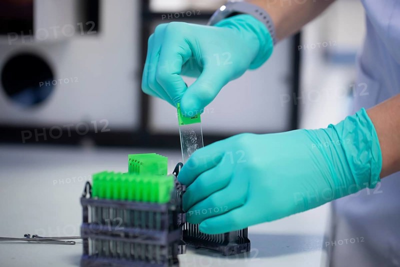Processing of samples in a histology laboratory