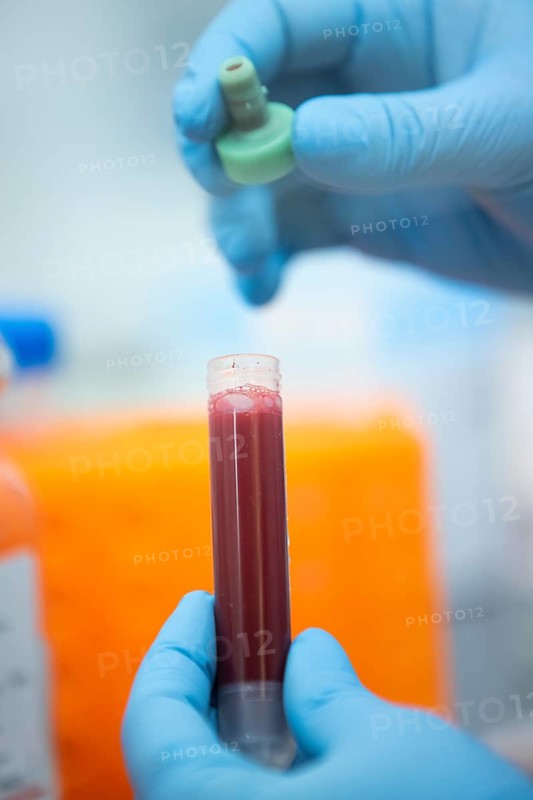Medical laboratory assistant holding a tube with blood