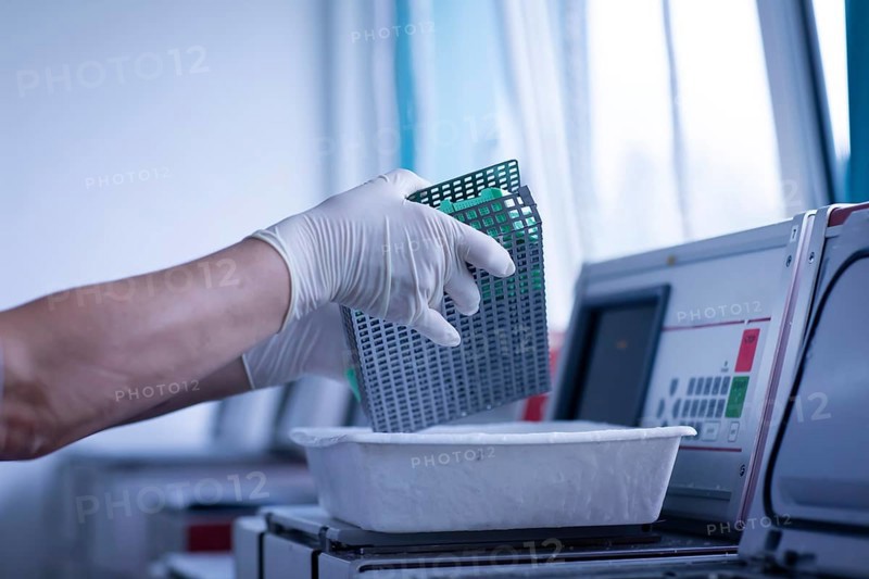 Sample processing with laboratory equipment in a histology laboratory