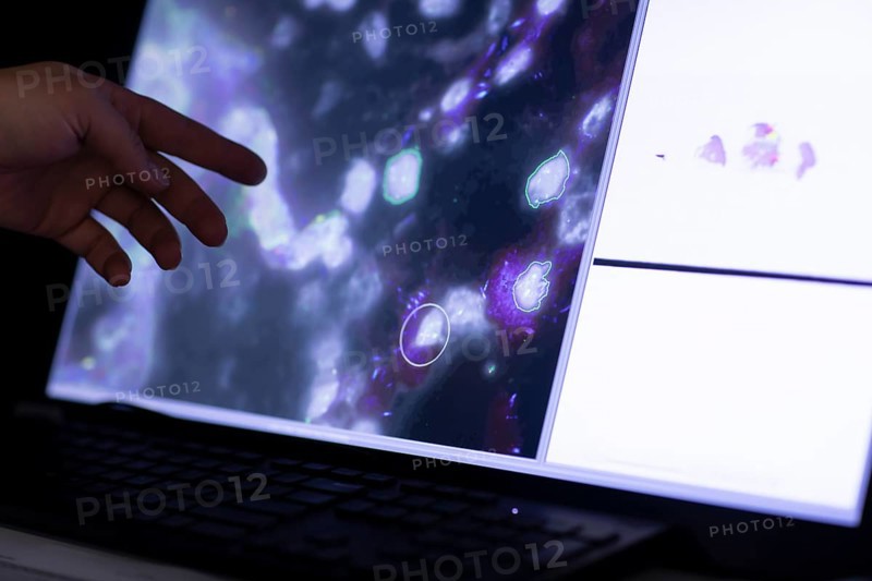 Sample evaluation on the monitor in a histology laboratory