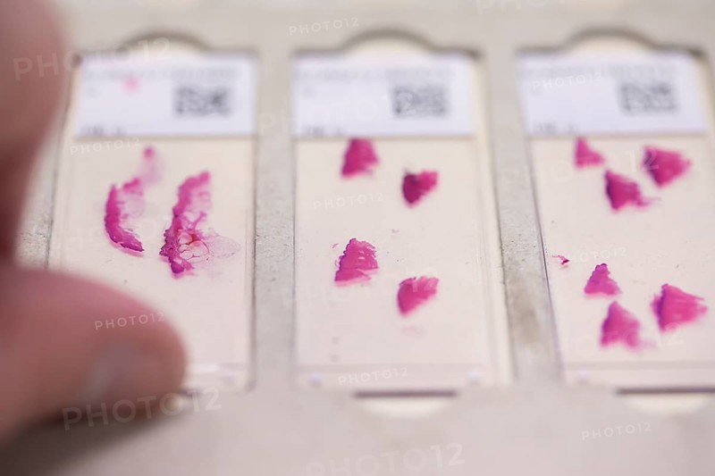 Embedded samples in a histology laboratory
