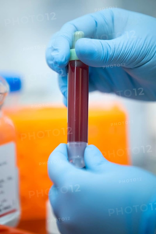 Medical laboratory assistant holding a tube with blood