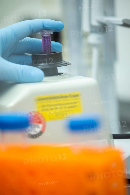 Hand of a medical laboratory assistant holding a reaction vessel in the centrifuge