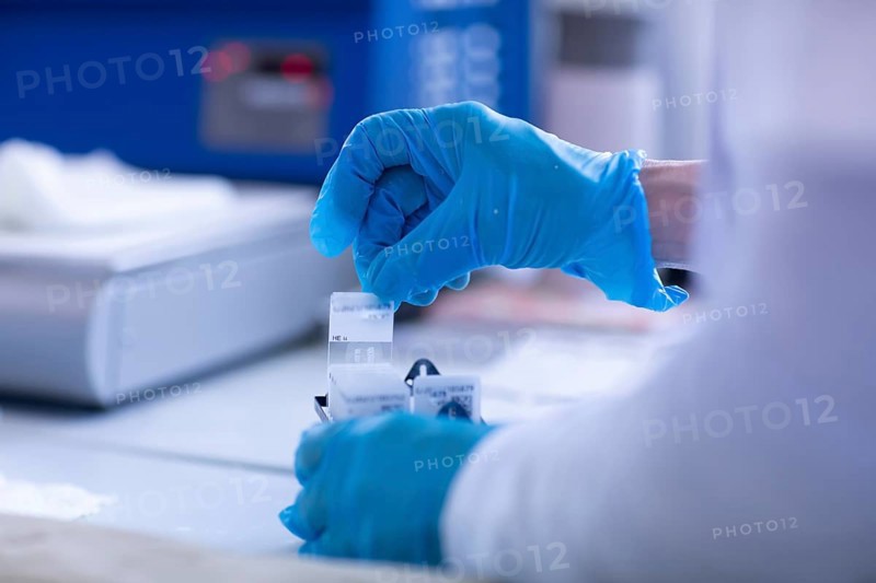 Processing of samples in a histology laboratory
