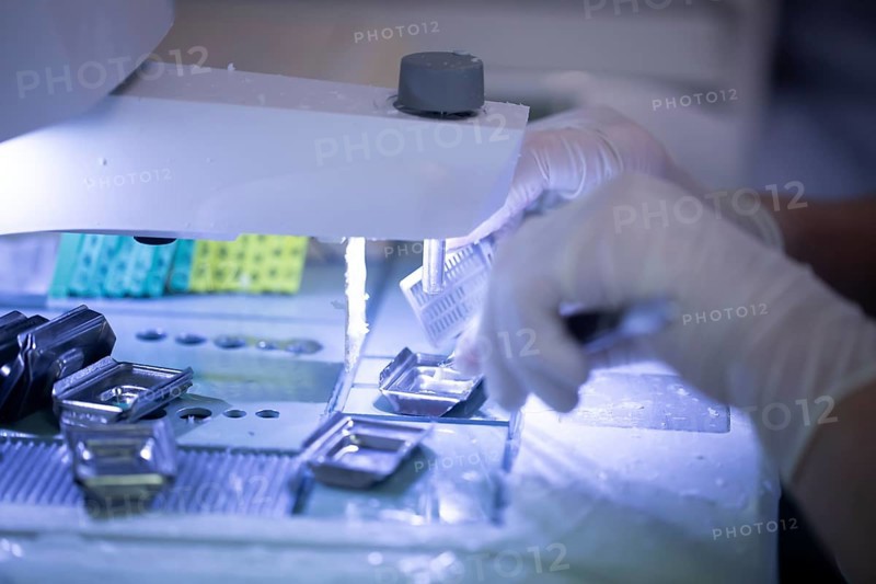 Processing of samples in a histology laboratory