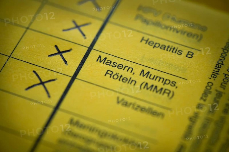 Measles