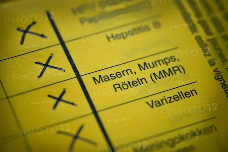 Measles