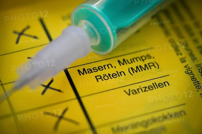 Measles