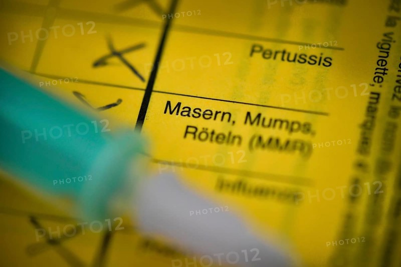 Measles