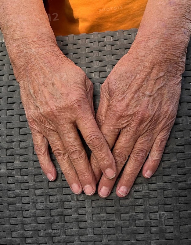 Wrinkled hands of an old woman on wickerwork of wicker chair