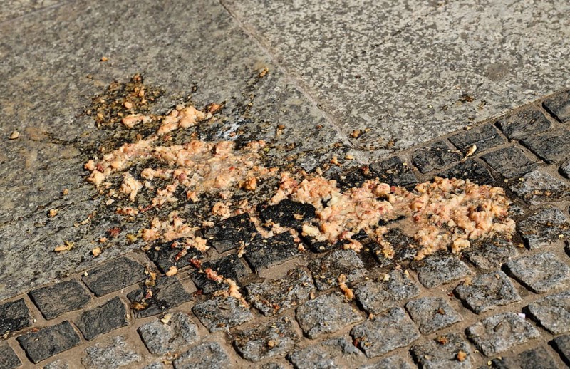 Vomit