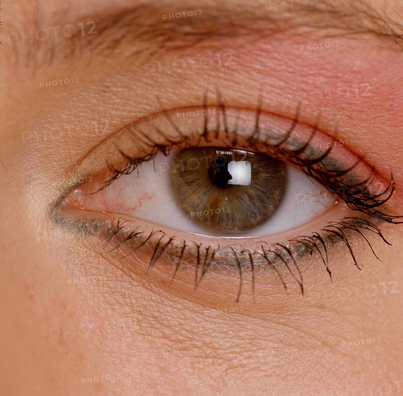Auge