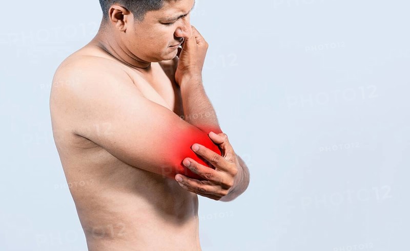 Person with elbow pain