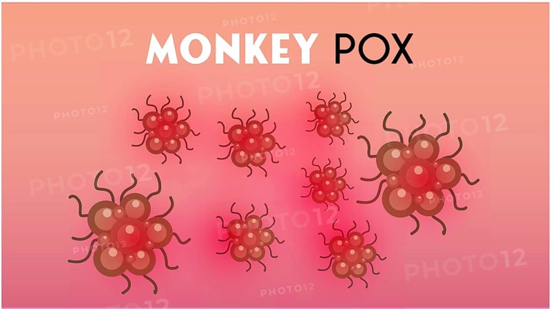 Monkeypox virus illustration