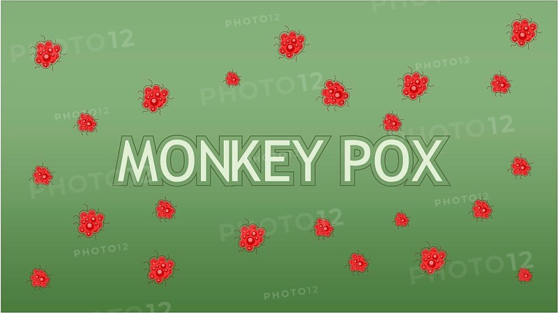 Monkeypox concept