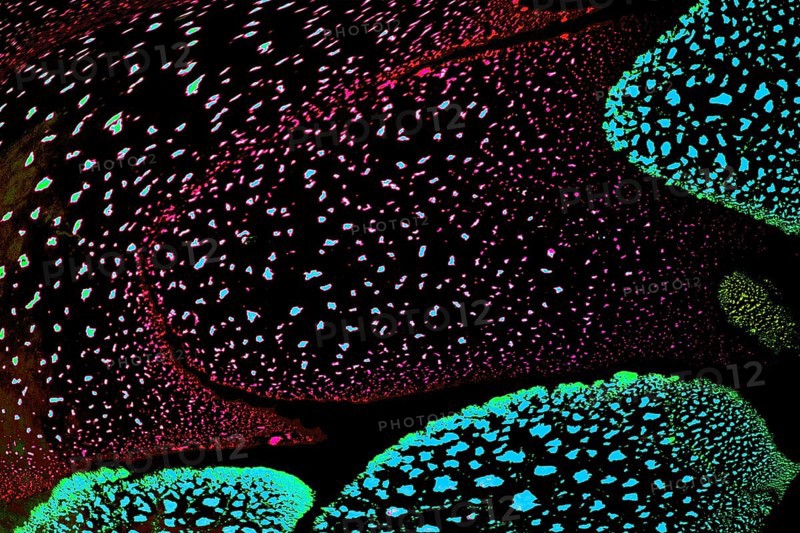 Oil bubbles inside water base form patterns