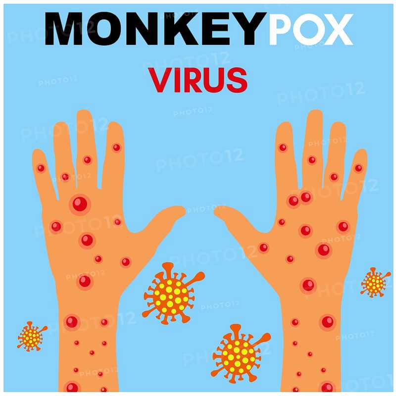 Monkeypox virus Illustration