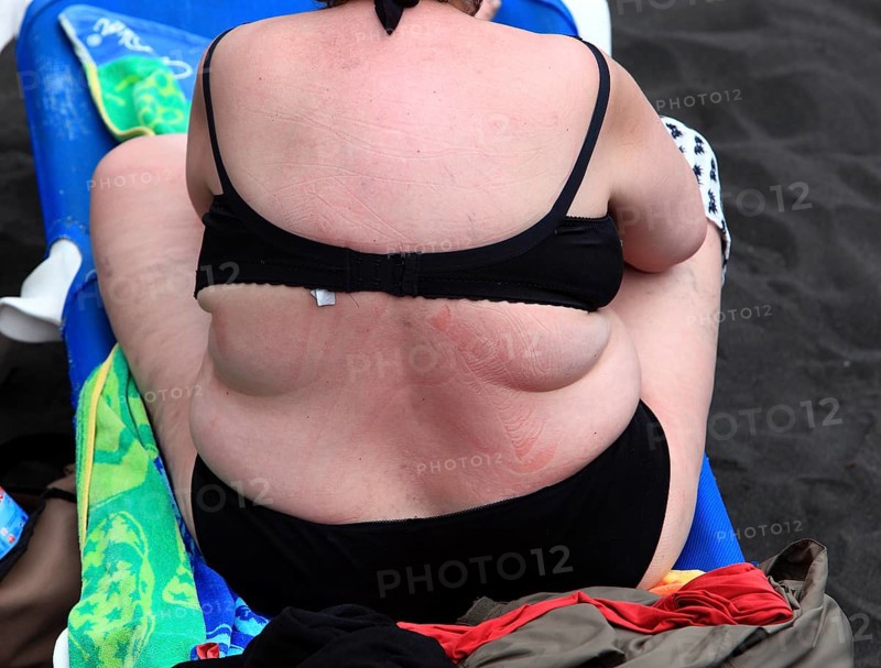 Back of an overweight woman
