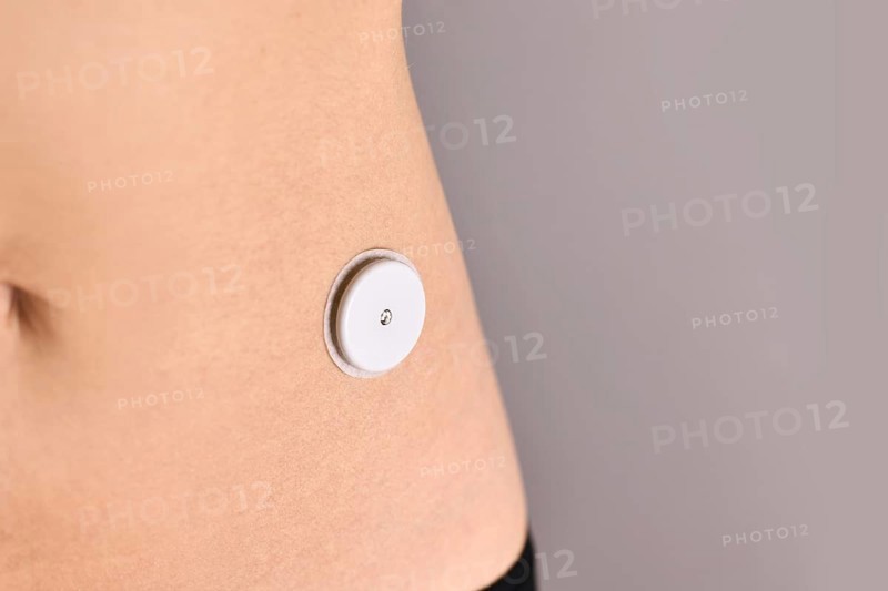 Sensor system for glucose monitoring attached to skin of person with diabetes illness used to permanently keep track of blood sugar level