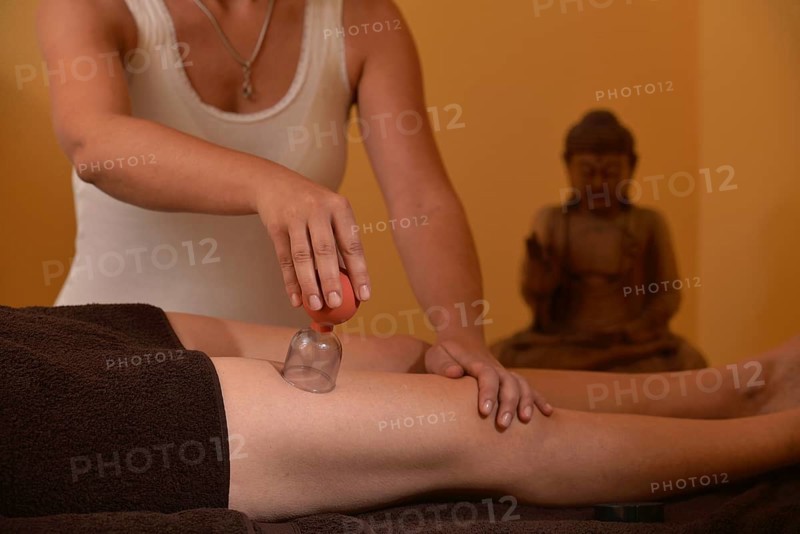 Cupping