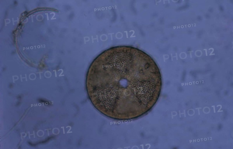 Acrinoptychus senarius living in plankton x130 magnification