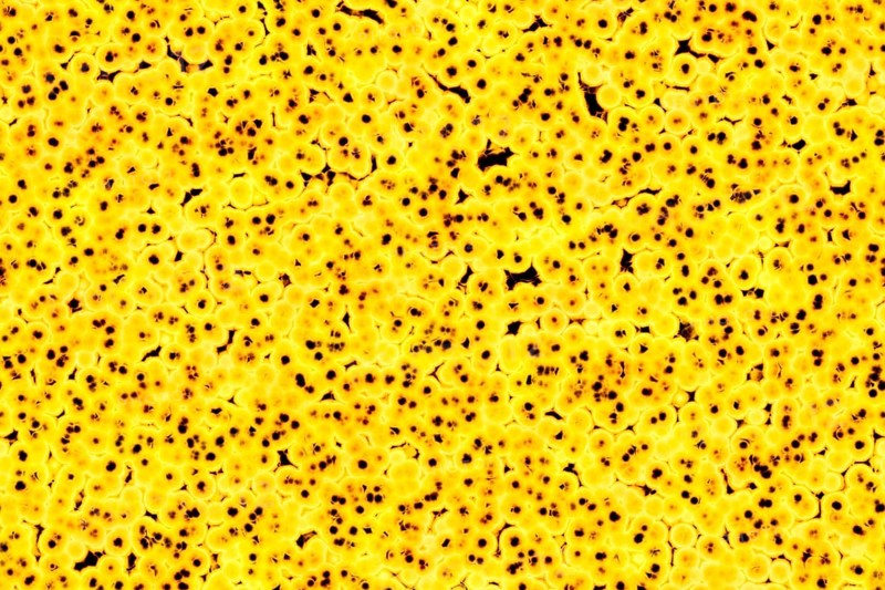 Shape of bacterial cell: cocci