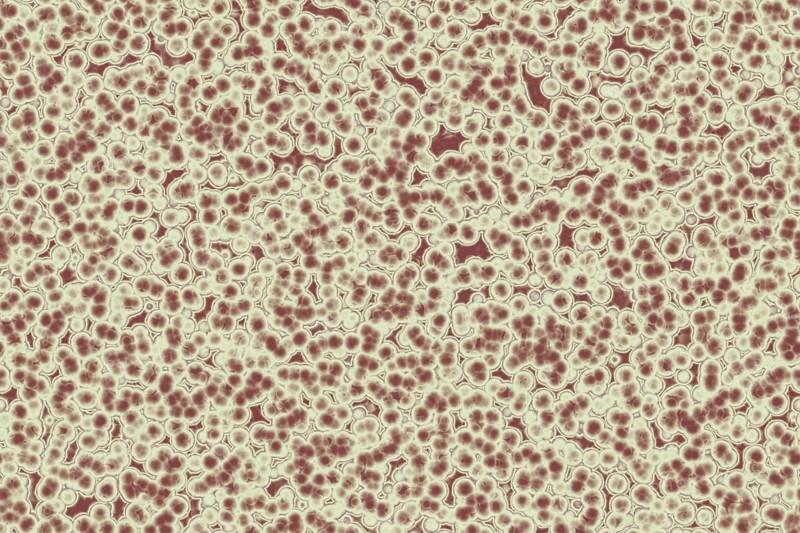 Shape of bacterial cell: cocci