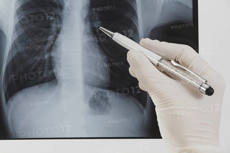 Radiography with pen. Resolution and high quality beautiful photo