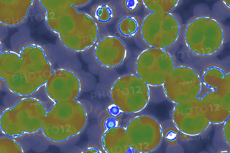 Shape of bacterial cell: cocci