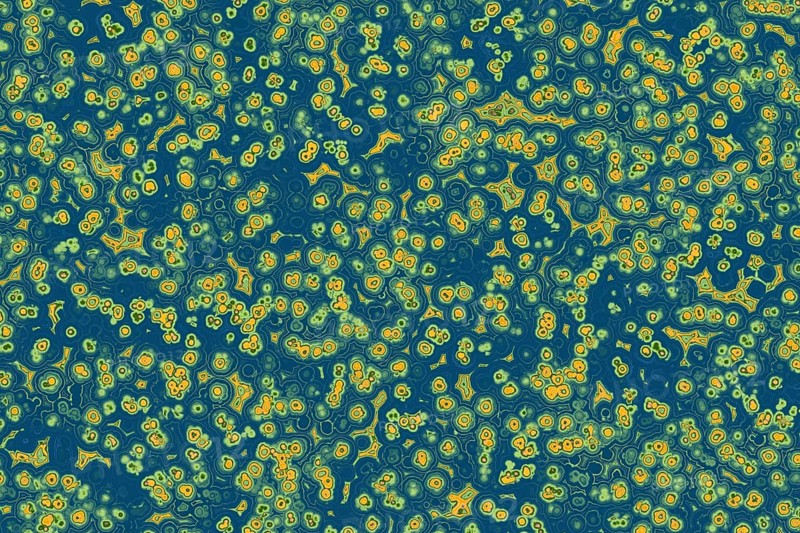 Shape of bacterial cell: cocci