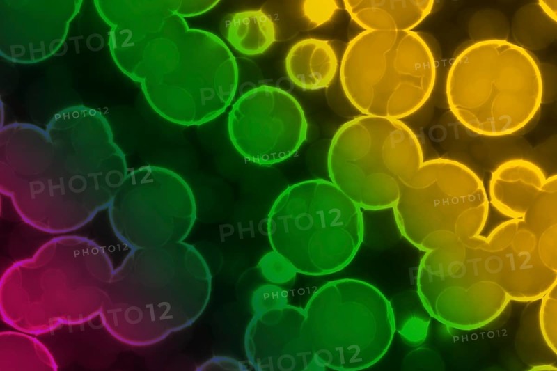 Shape of bacterial cell: cocci