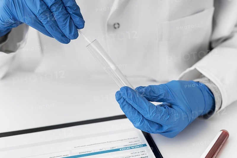 Close up hands holding covid sample