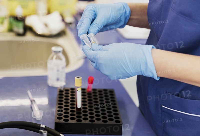 Close up doctor with small tubes