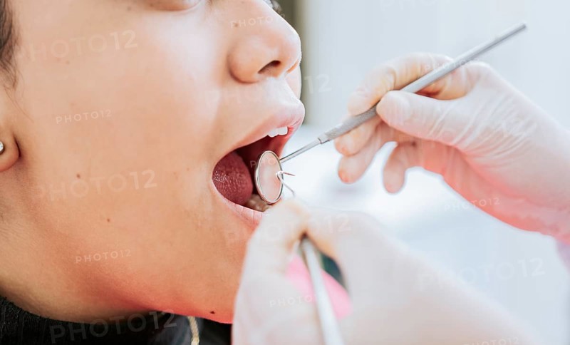 Close up of patient checked by dentist
