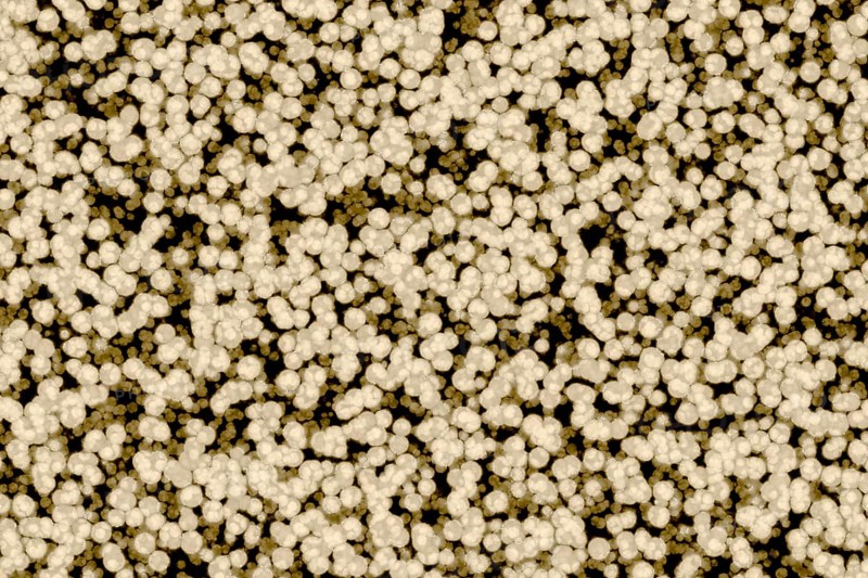 Shape of bacterial cell: cocci