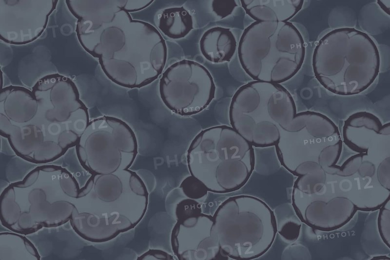 Shape of bacterial cell: cocci