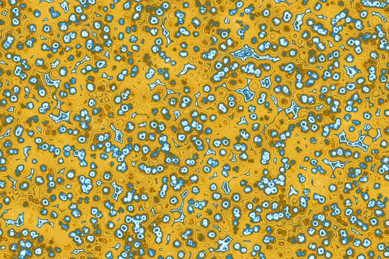 Shape of bacterial cell: cocci