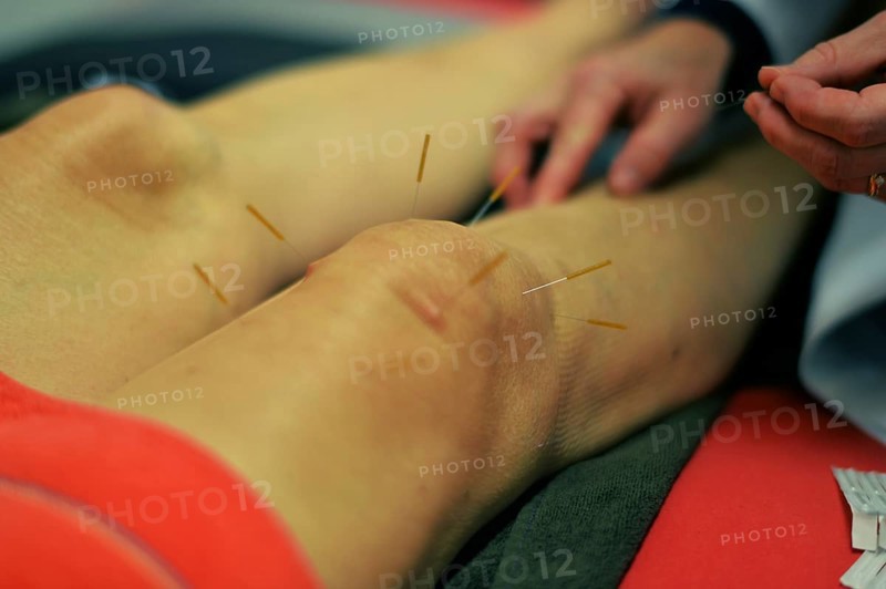 In the family doctor's consultation. Acupuncture