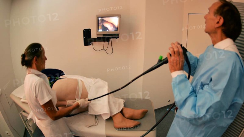 Colonoscopy