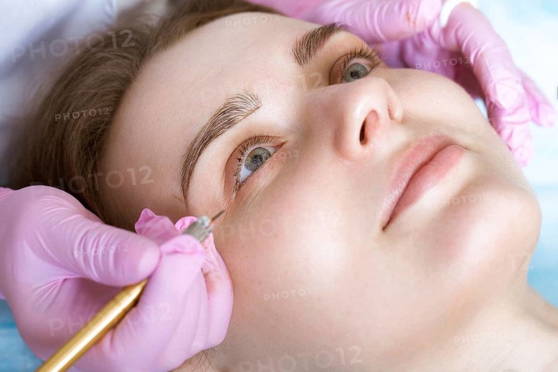 Permanent microblasting tattooing freckles to a woman in a beauty salon