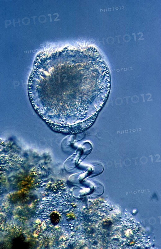 Vorticella