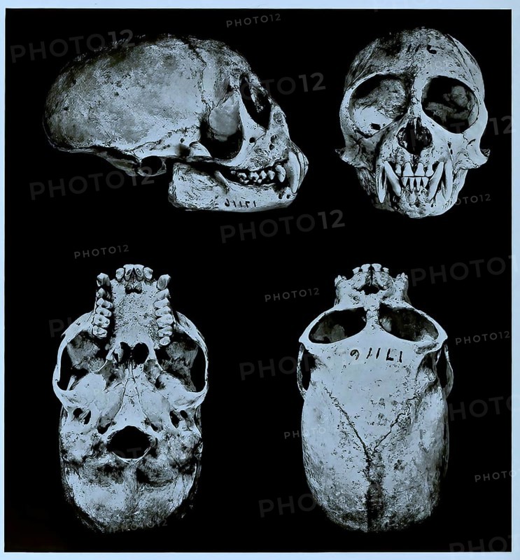 Skull bone