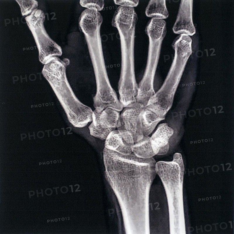 Mid 20th century X-ray photograph