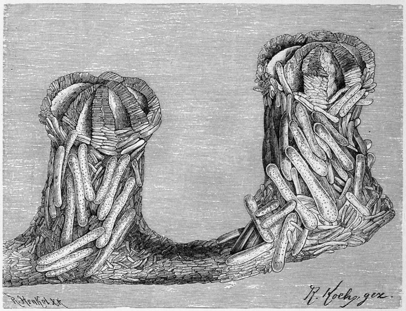 Bathygorgia profunda