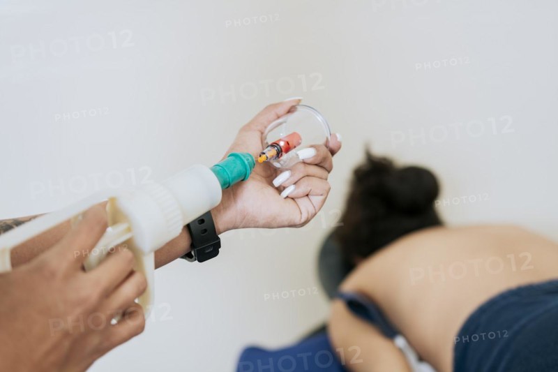 Close up of professional performing cupping treatment on patient