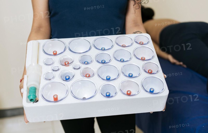 Physiotherapist hands holding cupping cups