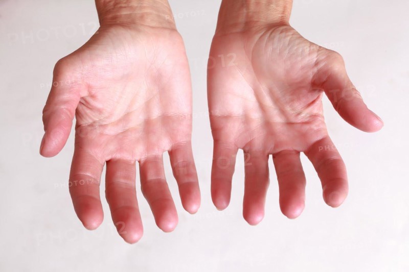 Outstretched empty palms with fingers spread