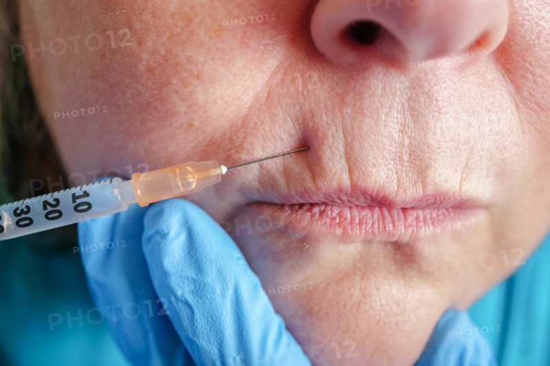 Older woman injected in lips Hyaluronic acid, Woman in beauty salon. plastic surgery clinic