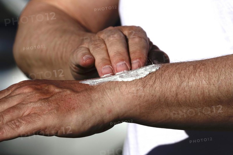 Man puts on sunscreen